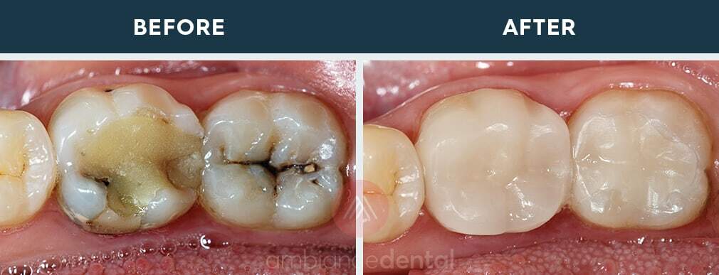 ambiance-dental-before-after-06