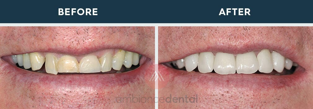 ambiance-dental-before-after-07