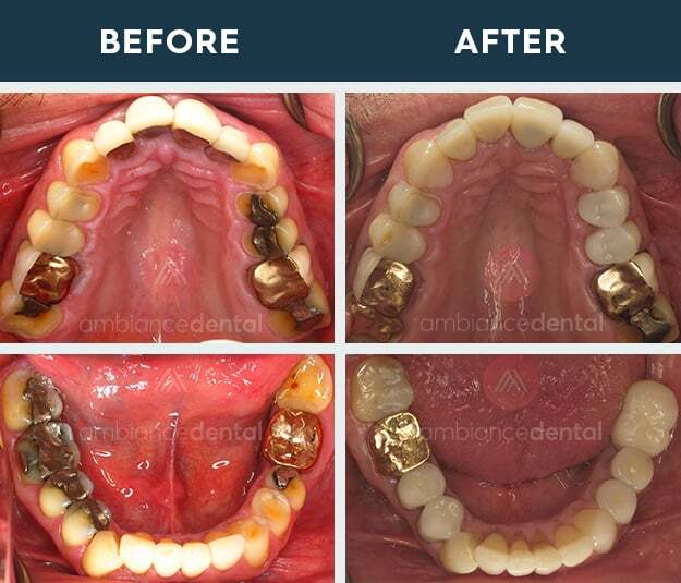 ambiance-dental-before-after-11