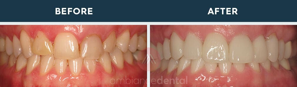 ambiance-dental-before-after-13