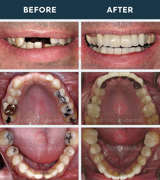 ambiance-dental-before-after-14