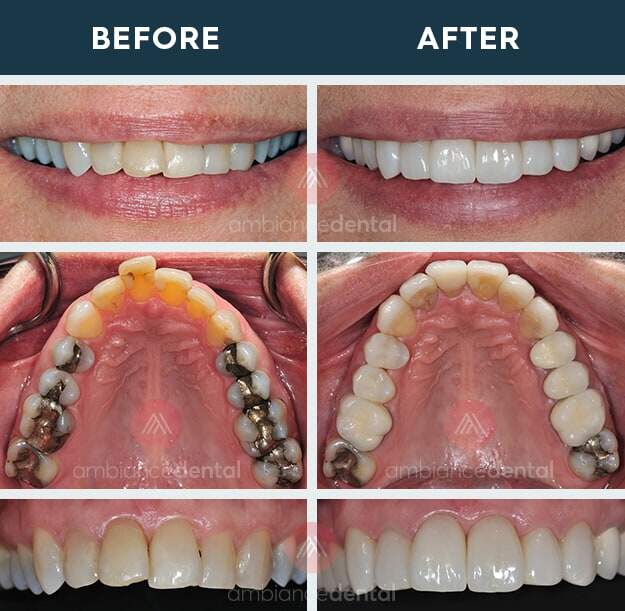 ambiance-dental-before-after-15