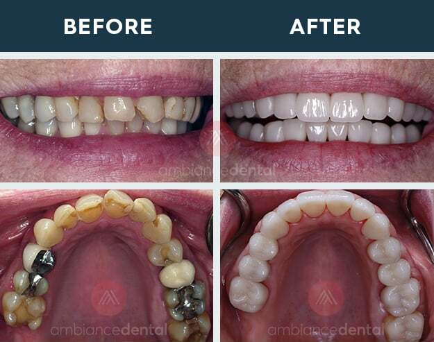 ambiance-dental-before-after-16