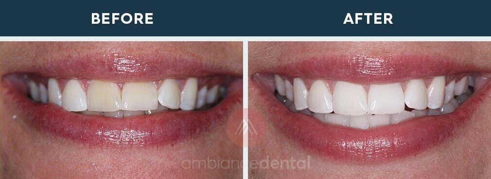 ambiance-dental-before-after-17