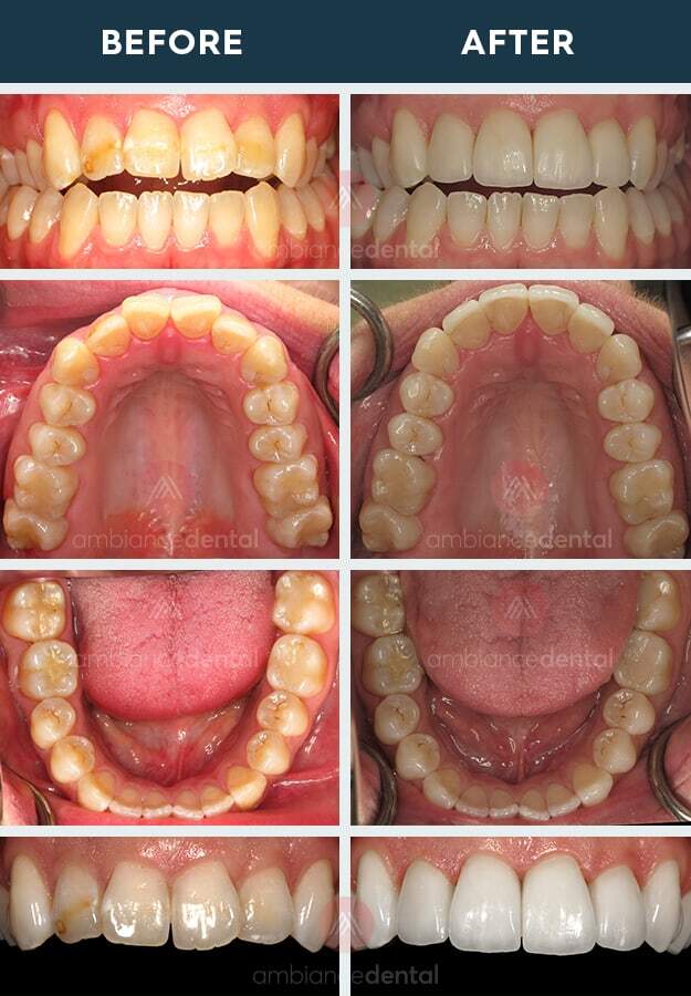 ambiance-dental-before-after-19