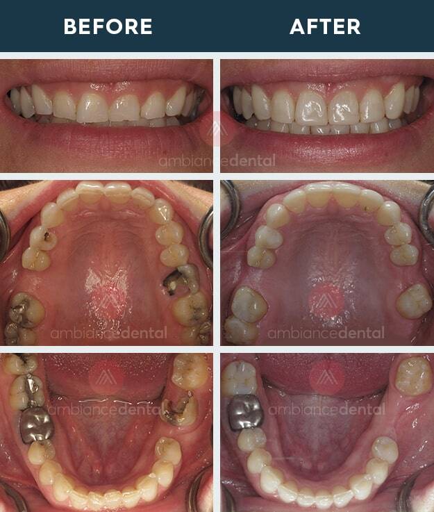 ambiance-dental-before-after-20
