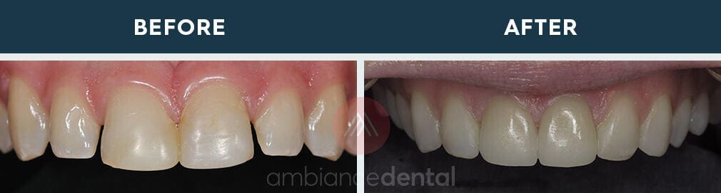 ambiance-dental-before-after-27