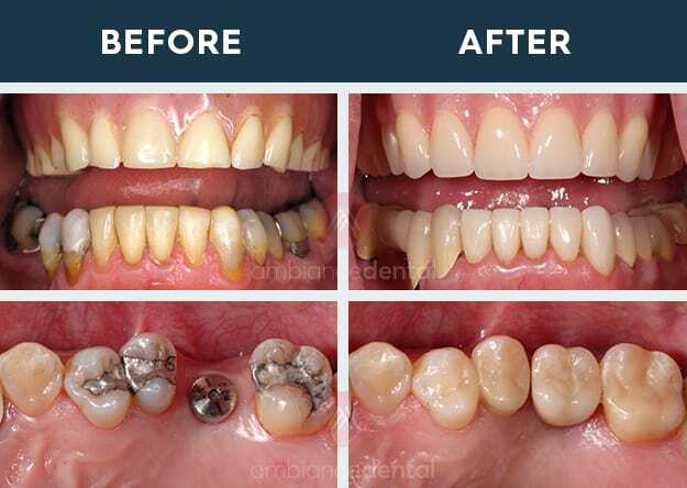 ambiance-dental-before-after-29