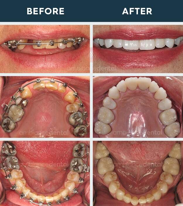 ambiance-dental-before-after-30