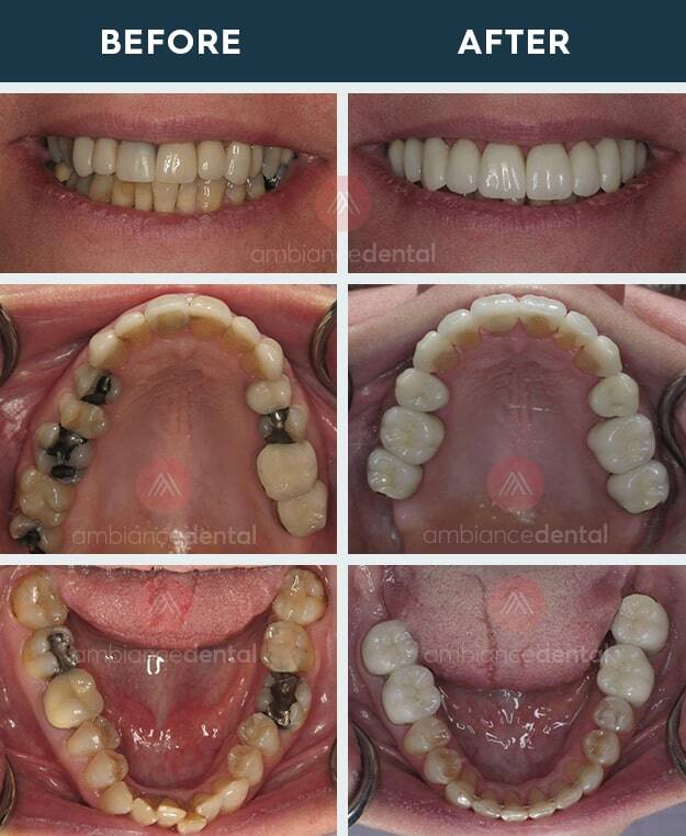 ambiance-dental-before-after-31