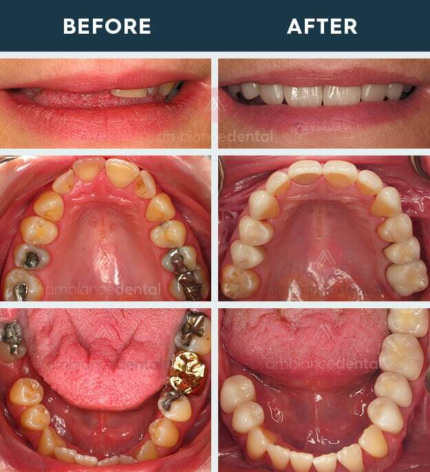 ambiance-dental-before-after-32