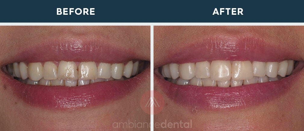 ambiance-dental-before-after-33
