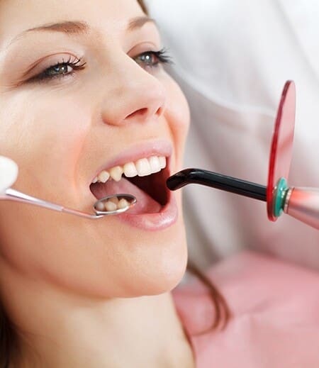 applying dental bonding in calgary