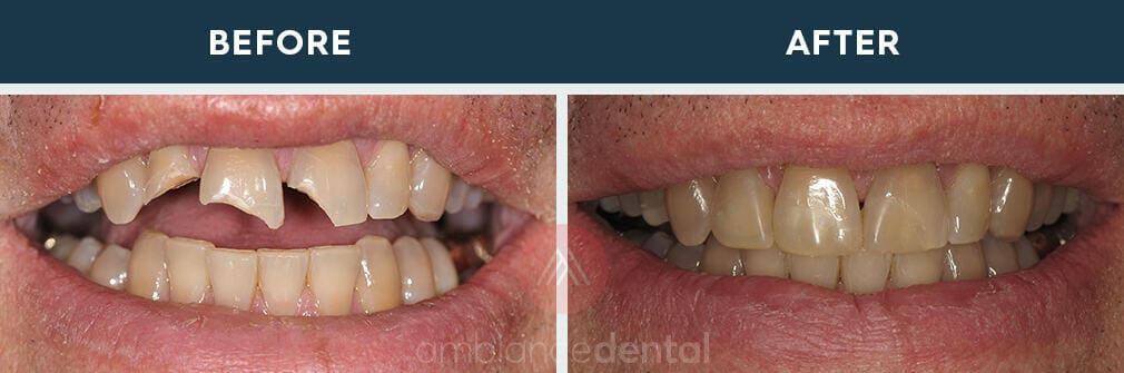 ambiance-dental-before-after-34