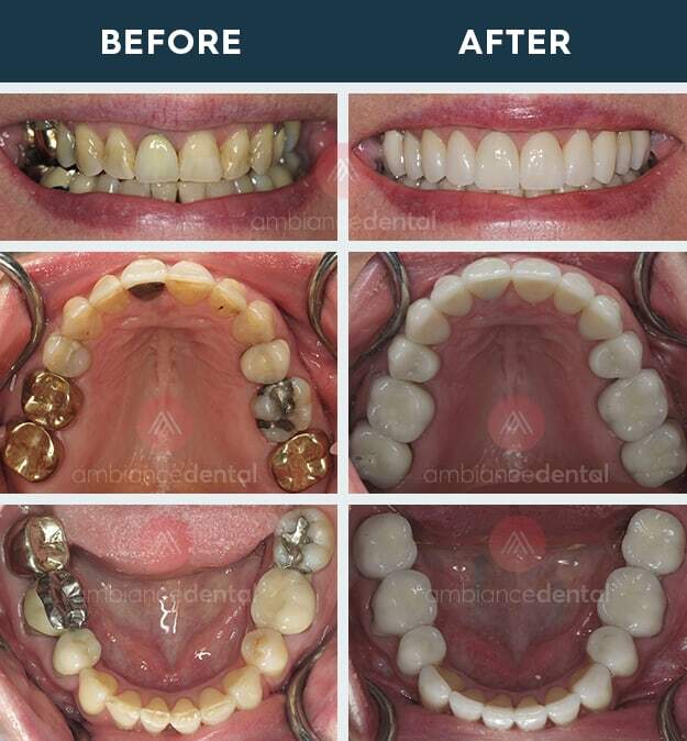 ambiance-dental-before-after-35