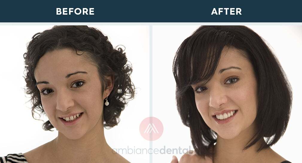 ambiance-dental-before-after-36